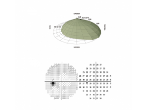 Standard Automated Perimetry